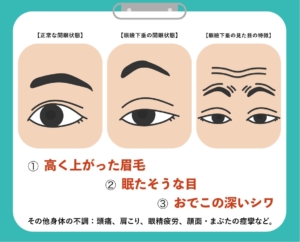 なぜ大人になってから二重になった まぶたの不思議に答えます 新さっぽろウィメンズ ヘルス ビューティークリニック