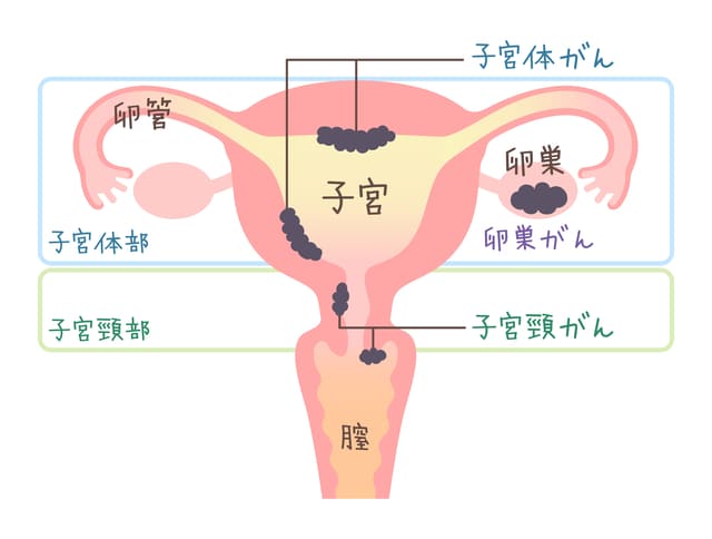 医療専門家の診察を受ける時期