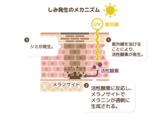 シミ発生のメカニズム
