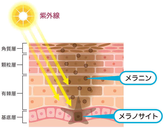 鼻の毛穴の黒ずみの原因とスキンケア方法 簡単にできるいちご鼻改善ケア 新さっぽろウィメンズ ヘルス ビューティークリニック