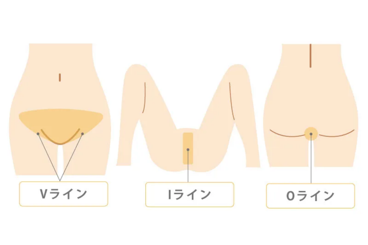 VIO脱毛の施術実績や対応範囲を確認する